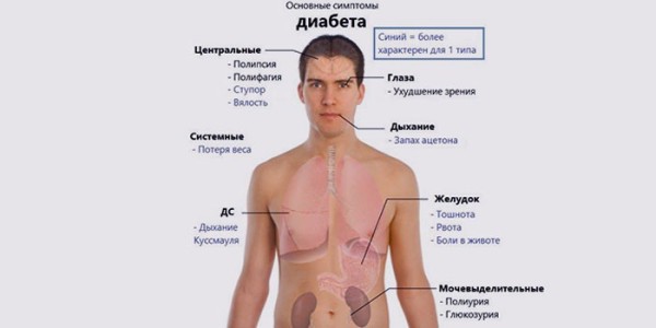 Признаки сахарного диабета у мужчин